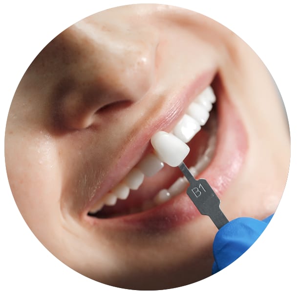 A clinical photograph from the Liphook Smile Studio image library