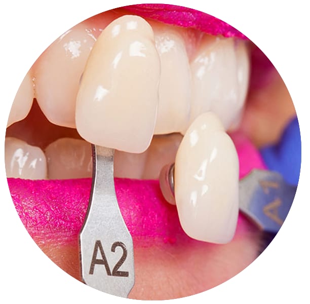 A clinical photograph from the Liphook Smile Studio image library