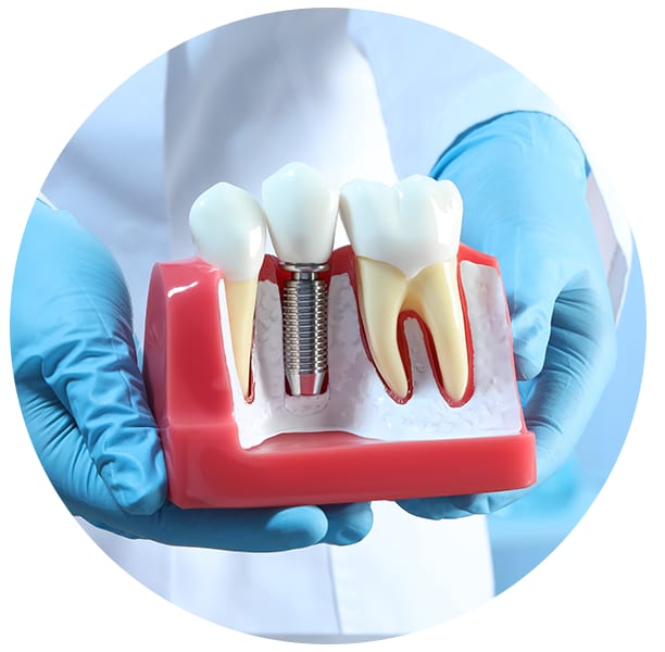 A clinical photograph from the Liphook Smile Studio image library
