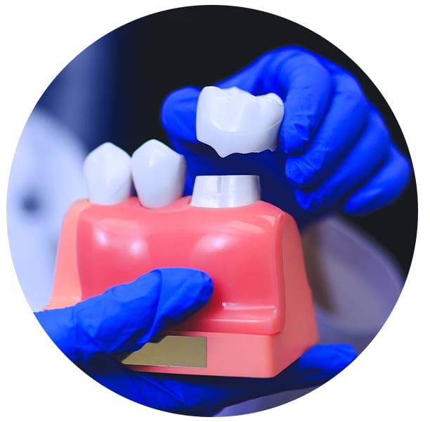 A clinical photograph from the Liphook Smile Studio image library
