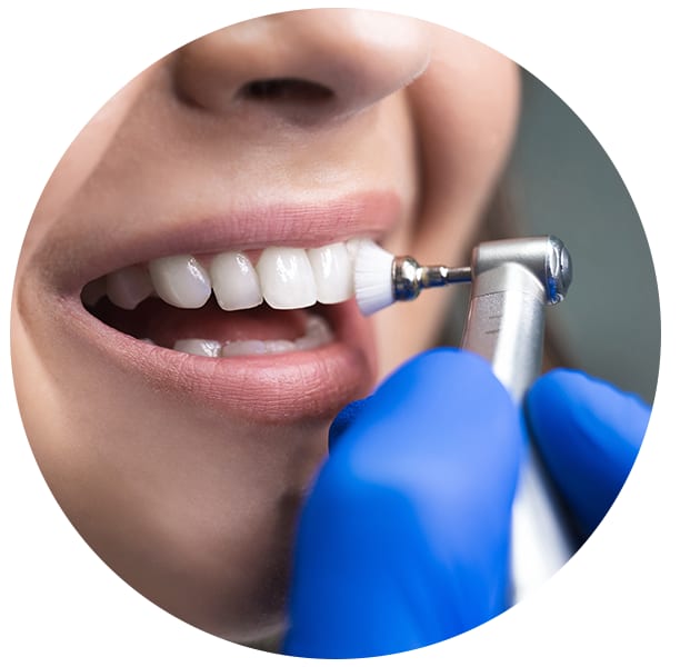 A clinical photograph from the Liphook Smile Studio image library
