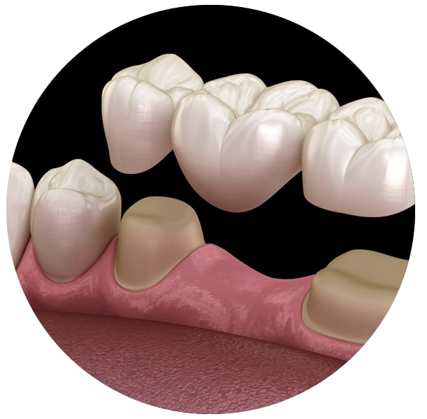 A clinical photograph from the Liphook Smile Studio image library