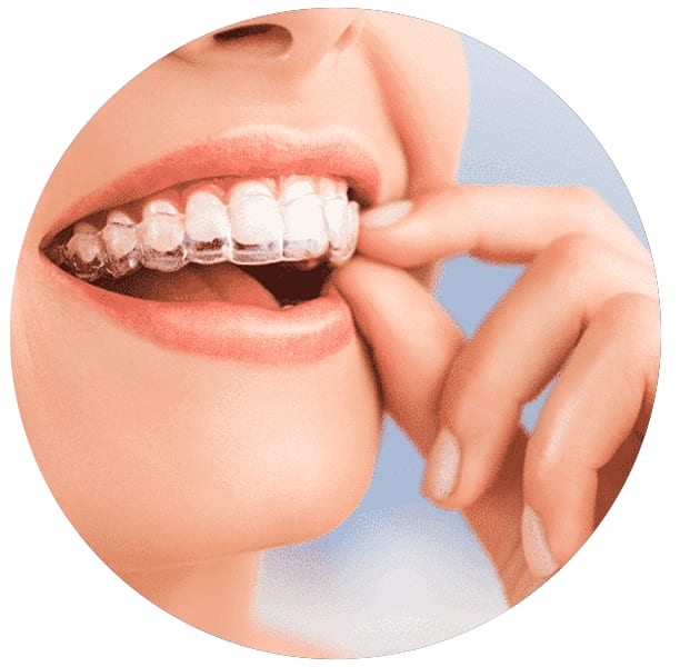 A clinical photograph from the Liphook Smile Studio image library