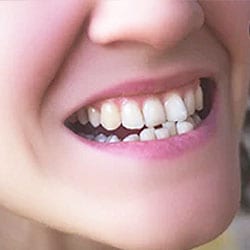 A clinical close-up from the practice’s image library