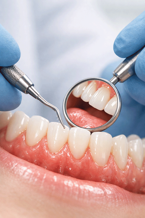 General-Dentistry Professional Painless Dentistry Near Me